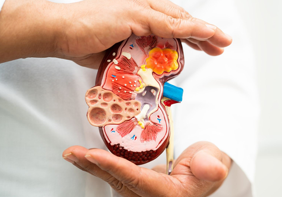 Kidney Function Test