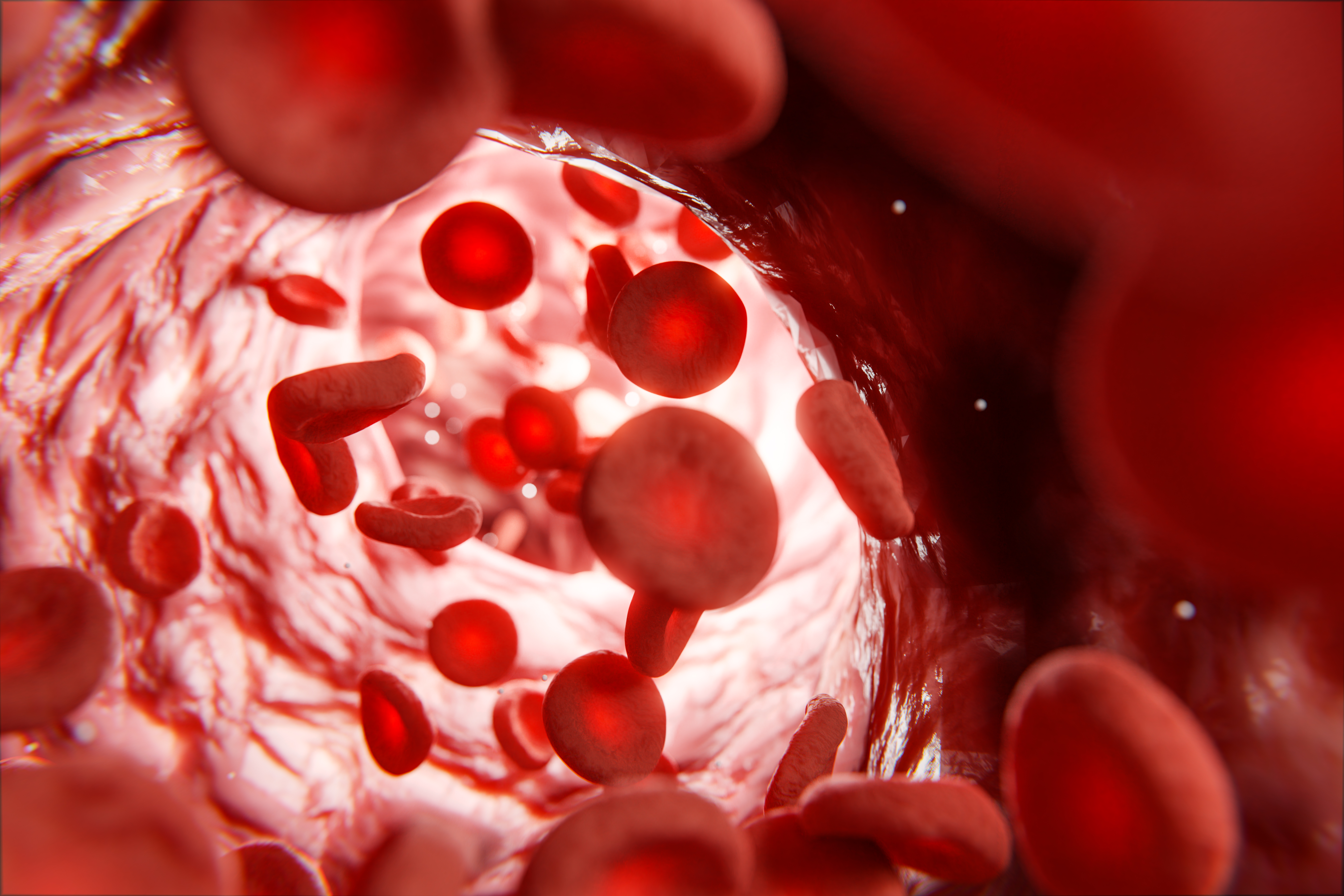 Anemia Profile